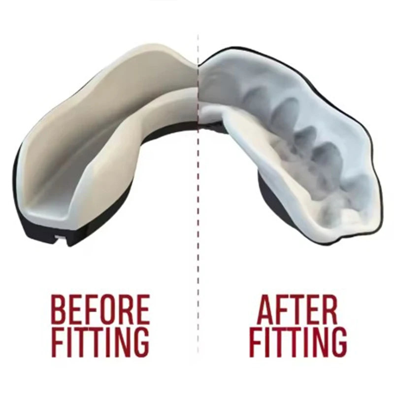 Adult Sports Mouthguard Muay Thai Boxing Teeth Protection Mma Fighting Mouth Guard Children Rugby Fight Training Braces